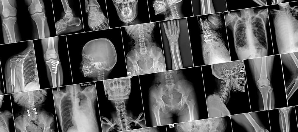 Imaging CT/MRI — X-ray